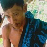 Relawan beri pertolongan warga Badui korban gigitan ular berbisa-1704283955